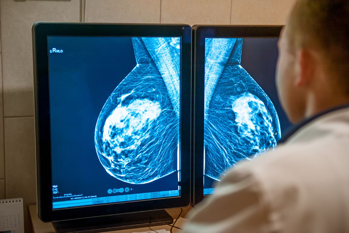 En doktor undersöker en röntgenbild av två bröst.